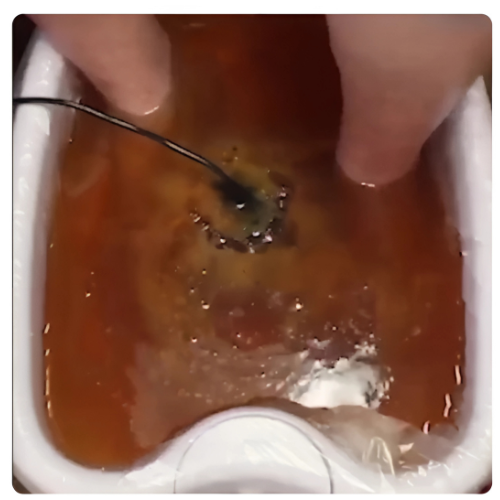 <h4>⭐️ ⭐️⭐️⭐️⭐️ </h4><p><strong>Meine Schwellungen sind zurück gegangen</strong></p>